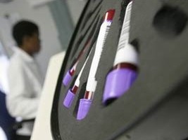 Haiti - Health : US alongside Haiti in the fight against tuberculosis