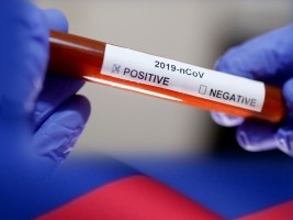Haiti - FLASH : 3rd death of Covid-19
