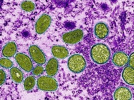 Haiti - Monkey Pox : The Ministry raises the level of alert in the country