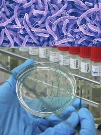 Haiti - Health : First case of cholera imported into the Dominican Republic