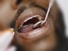 Haiti - Oral Health : The Ministry Launches a Call for National Mobilization