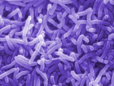 Haiti - Cholera : The Health Centre of Allegue, call for help