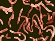 Haiti - Epidemic : First case of cholera in Cité Soleil ?