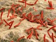 Haiti - Health : First case of leprosy in Chile diagnosed in a Haitian patient
