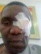 Haïti - FLASH : Le Président du Sénat, blessé dans une attaque d'individus armés