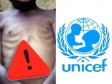 Haiti - FLASH : 1 out of 2 children will depend on humanitarian aid to survive in 2023