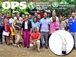 Haiti - Health Technology: Introduction of thermoablation in Haiti