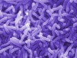 Haiti - Cholera : The Health Centre of Allegue, call for help